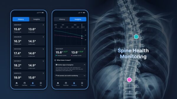 Alia app interface for scoliosis recovery and physical therapy